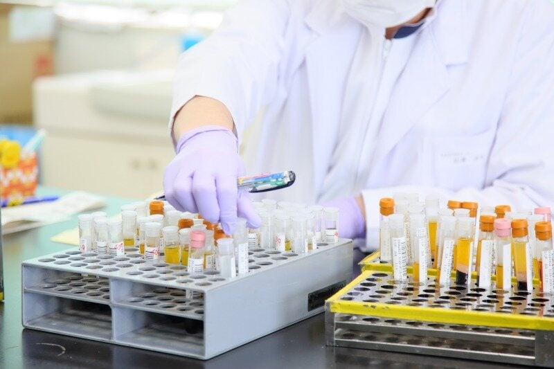 臨床検査STAFF｜経験不問｜社会保険完備｜交通費実費支給(医療・介護・福祉,札幌市中央区)のイメージ画像